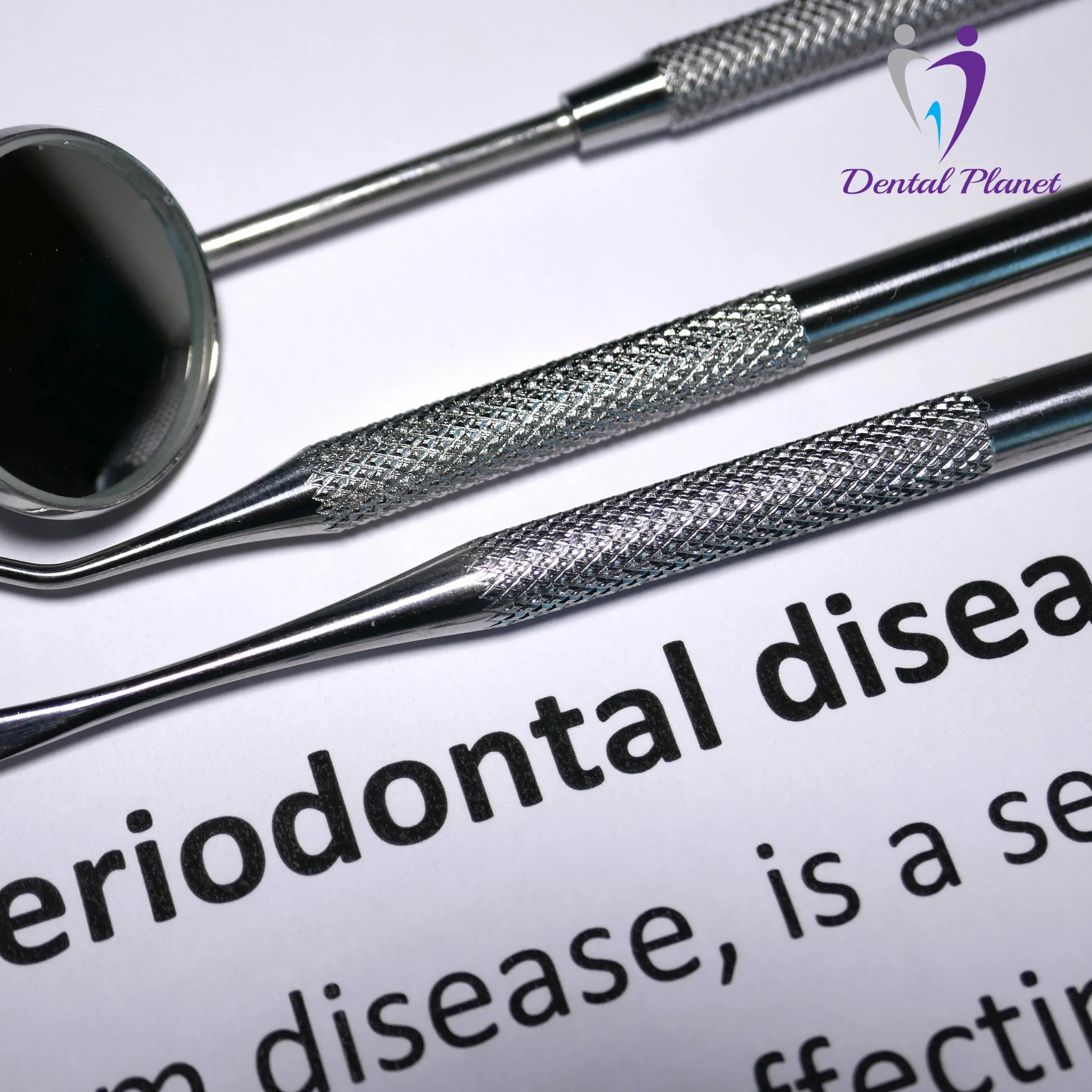 Laser Gum Depigmentation in Mysore: Treat Dark or Black Gums Permanently